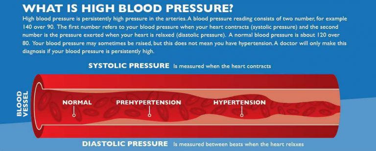 Common Comorbidities Covid-19 Update | Hypertension | Type 2 Diabetes